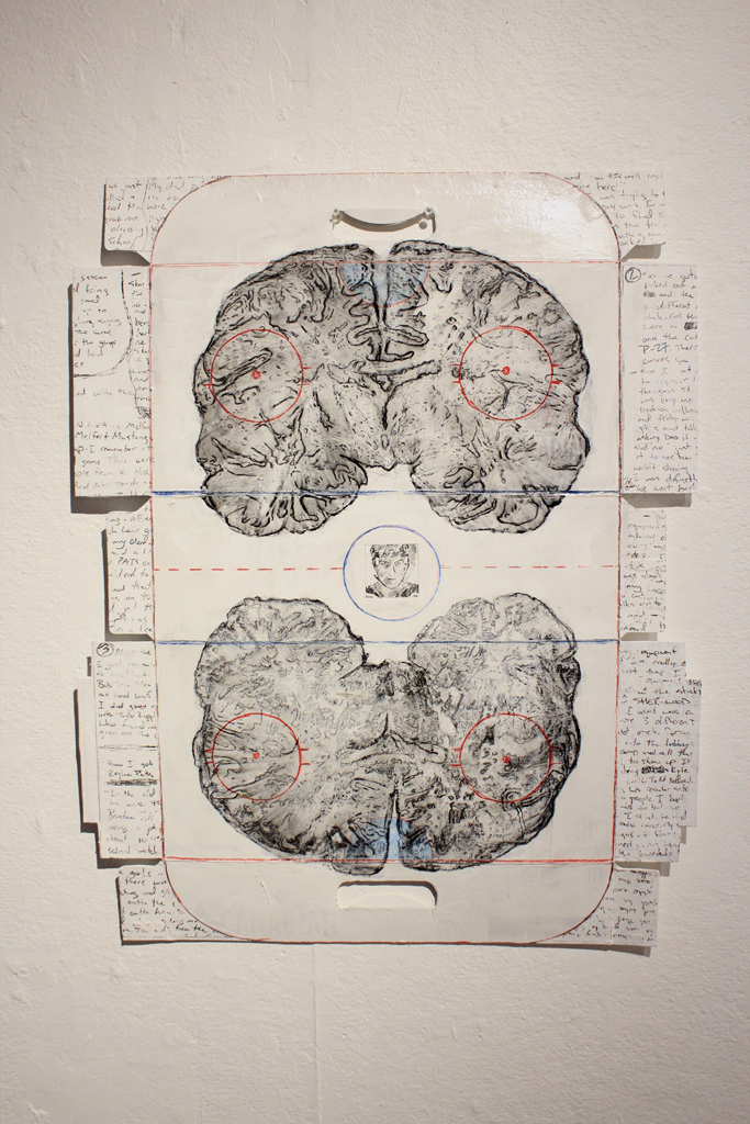 Artist Michael Conti’s “Punch Drunk” is a mixed media collage showcasing the effects of violent trauma and medication on the human brain.-Photos by Fermin Martinez