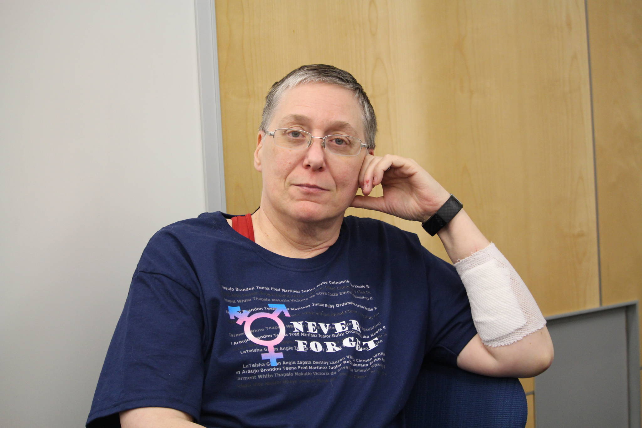 Tammie Willis is seen here at Kenai Peninsula College on Dec. 19, 2019. The bandage on her arm covers some of the cuts Willis received while being attacked at her home on Dec. 9. (Photo by Brian Mazurek/Peninsula Clarion)