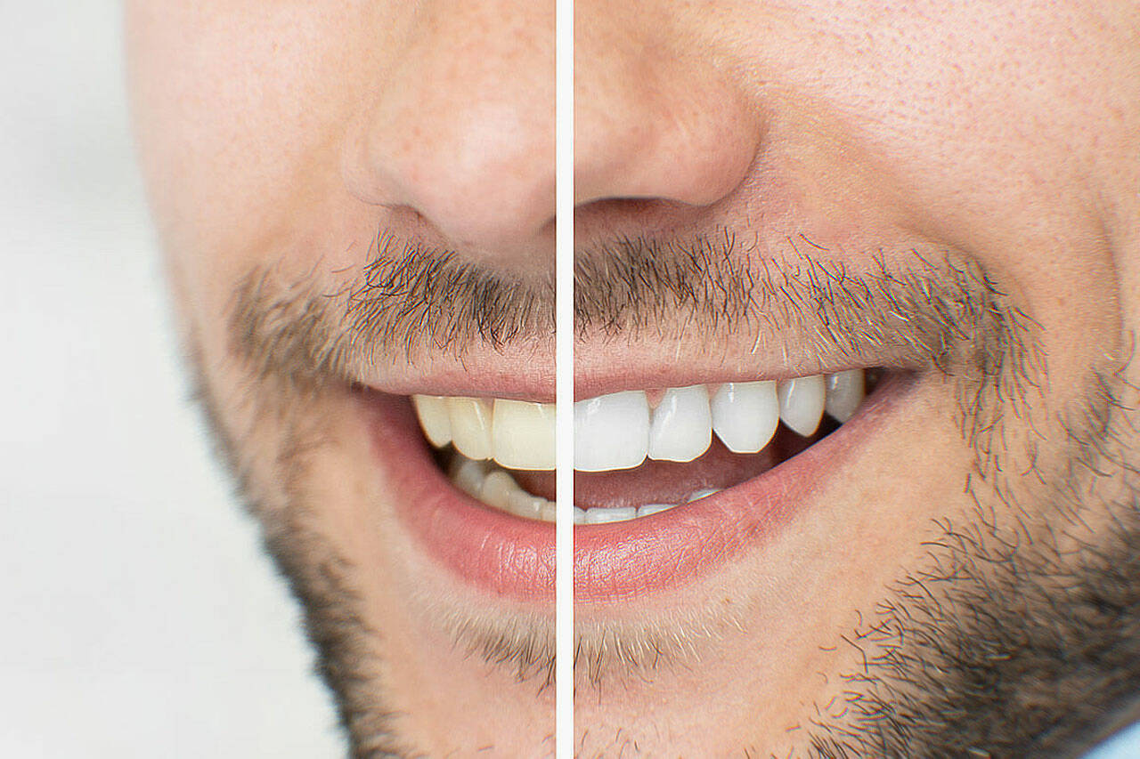 how do zimba whitening strips work