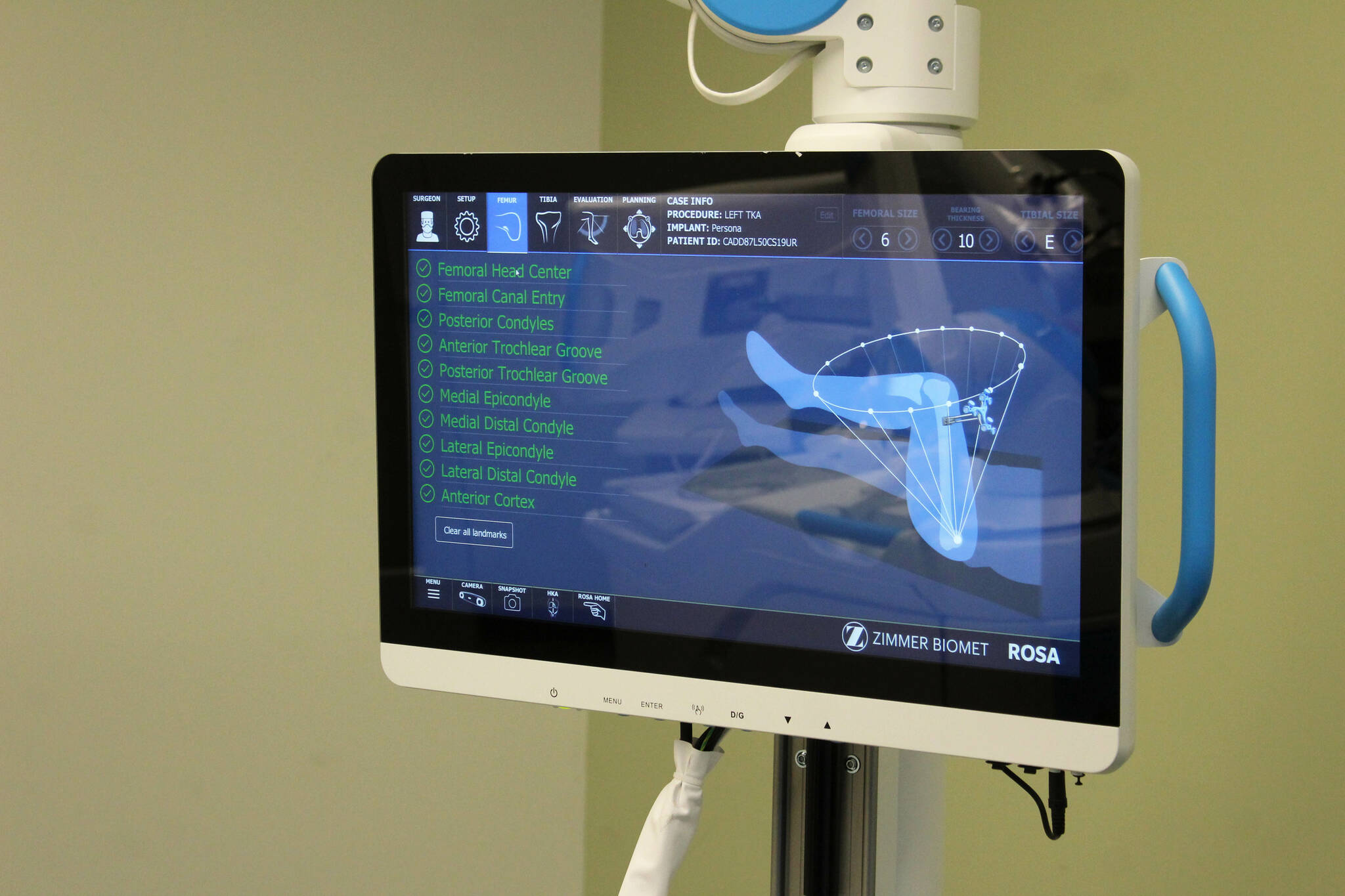 ROSA displays data about a model knee during a demonstration at Central Peninsula Hospital on Monday, Nov. 21, 2022, in Soldotna, Alaska. (Ashlyn O’Hara/Peninsula Clarion)
