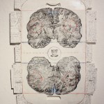 Artist Michael Conti’s “Punch Drunk” is a mixed media collage showcasing the effects of violent trauma and medication on the human brain.-Photos by Fermin Martinez